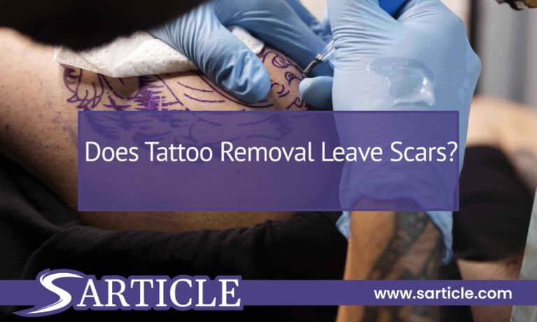 Does Tattoo Removal Leave Scars? The Truth Behind Tattoo Removal