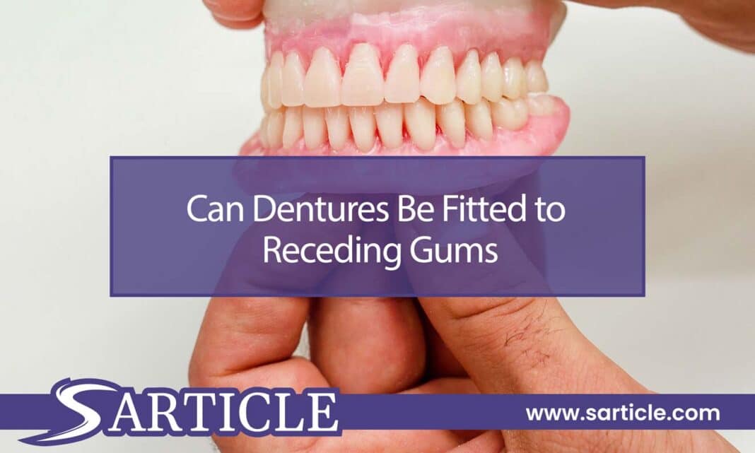 Can Dentures Be Fitted to Receding Gums